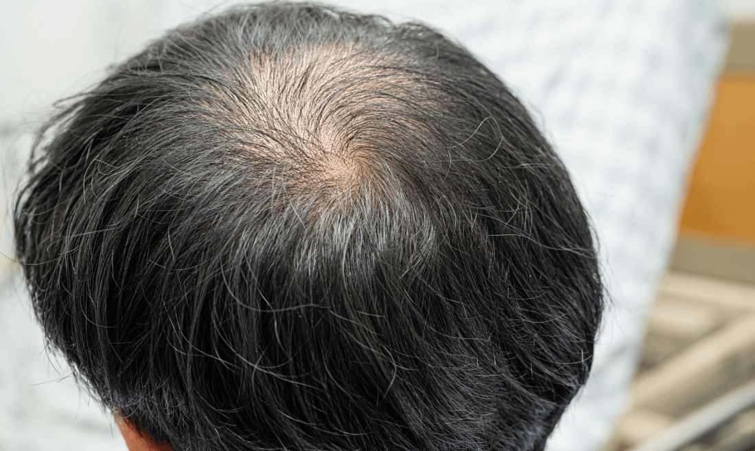 When to Consult a Dermatologist: Understanding Hair, Skin, and Nail Concerns