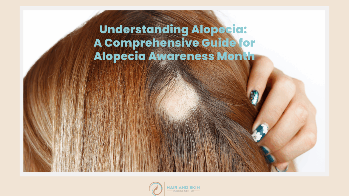 Understanding Alopecia: A Comprehensive Guide for Alopecia Awareness Month