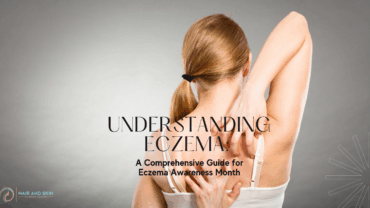 Understanding Eczema: A Comprehensive Guide for Eczema Awareness Month