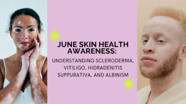June Skin Health Awareness: Understanding Scleroderma, Vitiligo, Hidradenitis Suppurativa, and Albinism