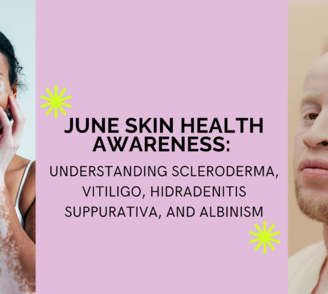 June Skin Health Awareness: Understanding Scleroderma, Vitiligo, Hidradenitis Suppurativa, and Albinism