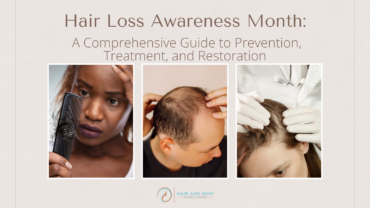 Hair Loss Awareness Month: A Comprehensive Guide to Prevention, Treatment, and Restoration