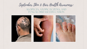 September Skin & Hair Health Awareness: Alopecia, Atopic Eczema, and Fungal Disease Education
